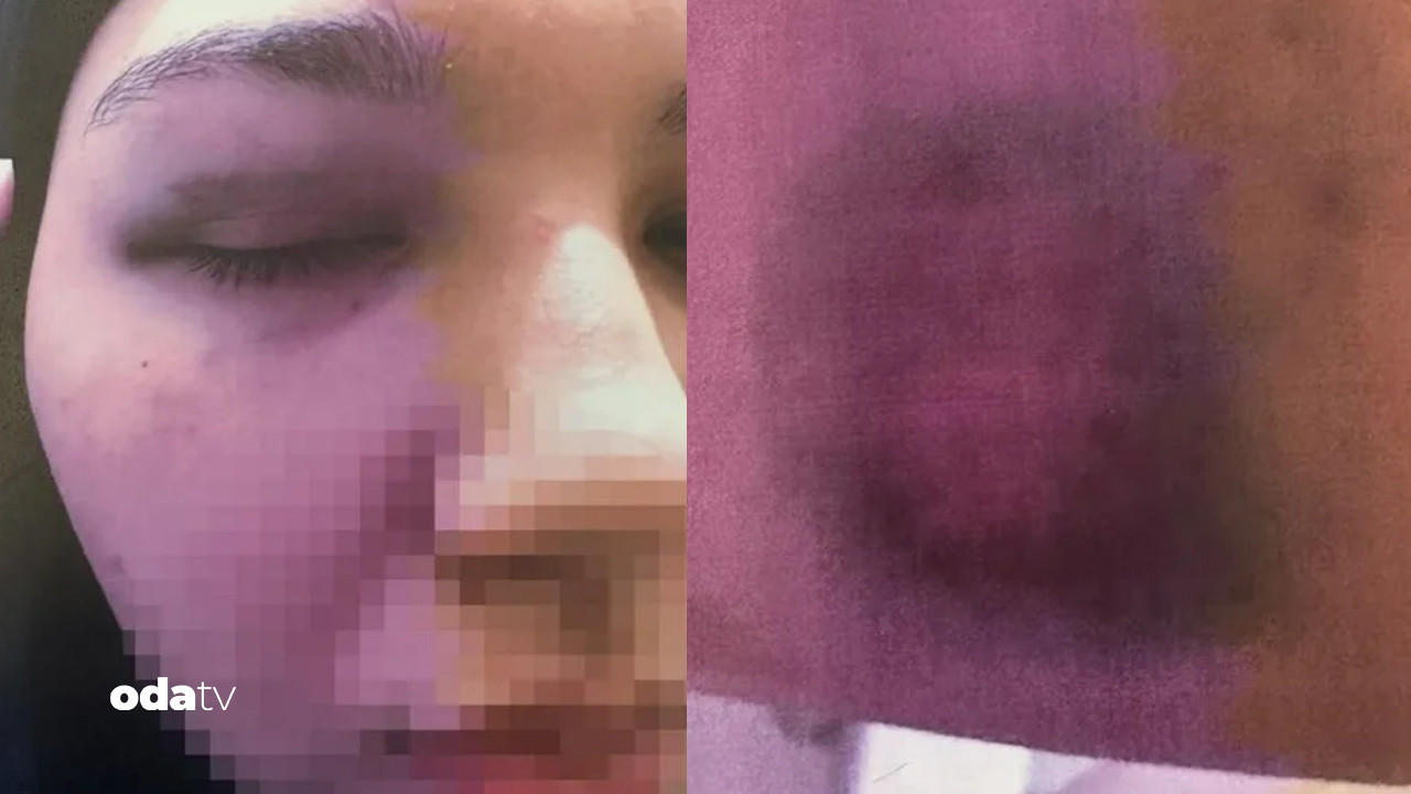 beyoglunda anne kiza bitmeyen siddet hem cinsel hem fiziki 6CUKfWxd